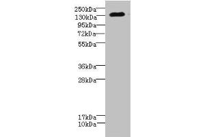 Western blot All lanes: CACNA2D2 antibody IgG at 4. (CACNA2D2 anticorps  (AA 20-200))