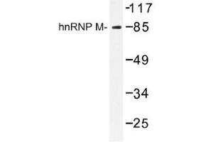 Image no. 1 for anti-Heterogeneous Nuclear Ribonucleoprotein M (HNRNPM) antibody (ABIN317716) (HNRNPM anticorps)