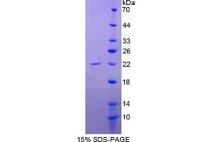 Image no. 1 for BCL2-Associated Agonist of Cell Death (BAD) (AA 1-168) protein (His tag) (ABIN4989173)