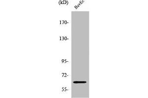 Western Blot analysis of HuvEc cells using ZNF329 Polyclonal Antibody (ZNF329 anticorps  (Internal Region))