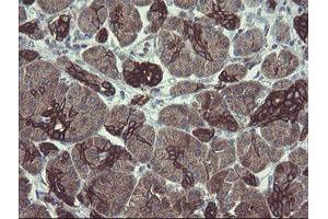 Image no. 5 for anti-Diphthamide Biosynthesis Protein 2 (DPH2) antibody (ABIN1497891)