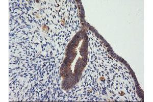 Image no. 6 for anti-Cancer/testis Antigen 1B (CTAG1B) antibody (ABIN1499889) (CTAG1B anticorps)