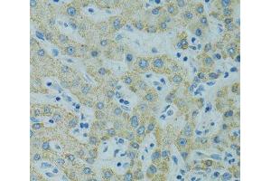 Immunohistochemistry of paraffin-embedded Human liver using STX1A Polyclonal Antibody at dilution of 1:100 (40x lens). (STX1A anticorps)