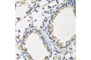 Immunohistochemistry of paraffin-embedded mouse lung using BMP2 antibody. (BMP2 anticorps  (AA 283-396))