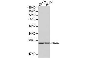 Western Blotting (WB) image for anti-Ras-Related C3 Botulinum Toxin Substrate 2 (Rho Family, Small GTP Binding Protein Rac2) (RAC2) antibody (ABIN1874525)