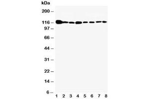 Western blot testing of Vinculin antibody and Lane 1:  rat heart