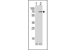 Western blot analysis of SK (arrow) using rabbit polyclonal SK Antibody  (ABIN392497 and ABIN2842067).