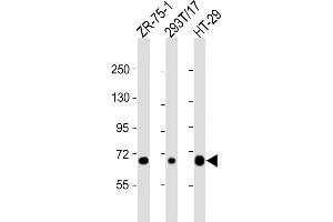 All lanes : Anti-SLC28A1 Antibody (Center) at 1:2000 dilution Lane 1: ZR-75-1 whole cell lysate Lane 2: 293T/17 whole cell lysate Lane 3: HT-29 whole cell lysate Lysates/proteins at 20 μg per lane. (SLC28A1 anticorps  (AA 381-409))