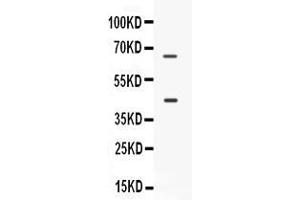 Western blot analysis of CD33 expression in SKOV3 whole cell lysates ( Lane 1). (CD33 anticorps  (AA 18-259))