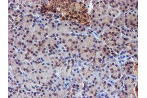 Image no. 7 for anti-RuvB-Like 2 (E. Coli) (RUVBL2) (AA 113-370) antibody (ABIN1490851)