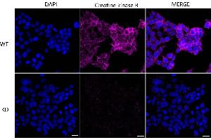 Immunocytochemical staining of HeLa cells using Creatine kinase B antibody (ABIN7798163), 1:1,000), Top panel: wild-type (WT), Bottom panal: Creatine kinase B shRNA knockdown (KD). (Recombinant CKB anticorps)