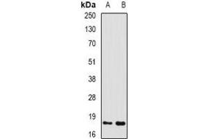 Western blot analysis of GADD45 alpha expression in mouse liver (A), mouse kidney (B) whole cell lysates. (GADD45A anticorps)