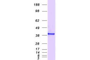 Validation with Western Blot