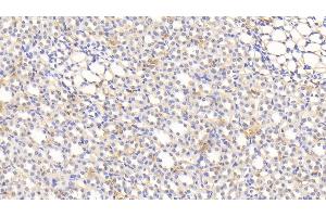 Detection of HB in Rat Kidney Tissue using Polyclonal Antibody to Hemoglobin (HB) (Hemoglobin anticorps)