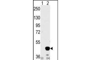 Western blot analysis of P2K2 (arrow) using P2K2 Antibody (Center) (ABIN392485 and ABIN2842062).