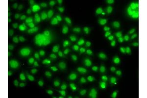 Immunofluorescence analysis of MCF-7 cells using SOX14 antibody.