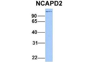 Host:  Rabbit  Target Name:  NCAPD2  Sample Type:  Hela  Antibody Dilution:  1. (NCAPD2 anticorps  (C-Term))