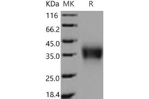 Western Blotting (WB) image for Fc Fragment of IgG, Low Affinity IIb, Receptor (CD32) (FCGR2B) (Active) protein (His tag) (ABIN7195694)