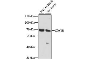 Western blot analysis of extracts of various cell lines, using CDY1B antibody (ABIN7266365) at 1:1000 dilution. (CDY1B anticorps  (AA 60-320))