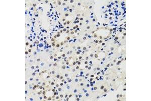 Immunohistochemistry of paraffin-embedded mouse kidney using CIRBP antibody.