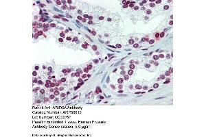 Immunohistochemistry with Human Prostate lysate tissue at an antibody concentration of 5.
