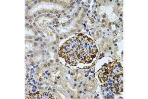 Immunohistochemistry of paraffin-embedded rat kidney using CETP antibody.
