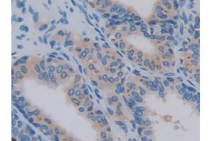 Used in DAB staining on fromalin fixed paraffin- embedded lung tissue (IL17RA anticorps  (AA 377-534))