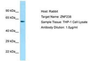 Image no. 1 for anti-Zinc Finger Protein 238 (ZNF238) (AA 143-192) antibody (ABIN6749839) (ZNF238 anticorps  (AA 143-192))