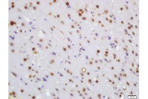 Formalin-fixed and paraffin embedded rat brain labeled with Rabbit Anti-WRB Polyclonal Antibody, Unconjugated (ABIN1387386) at 1:200 followed by conjugation to the secondary antibody and DAB staining (WRB anticorps  (AA 71-174))