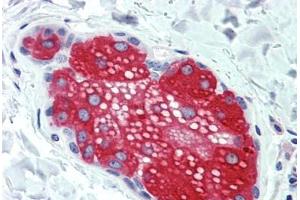 Anti-SUSD2 antibody  ABIN960825 IHC staining of human skin, sebaceous gland. (SUSD2 anticorps  (Internal Region))