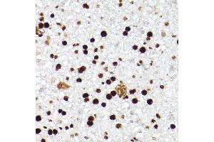 Immunohistochemistry of paraffin-embedded mouse liver using MCM2 Rabbit mAb (ABIN7268538) at dilution of 1:100 (40x lens).