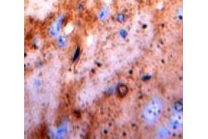 IHC-P analysis of Brain tissue, with DAB staining. (Pkc beta 1 anticorps  (AA 342-600))