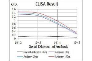 Black line: Control Antigen (100 ng), Purple line: Antigen(10 ng), Blue line: Antigen (50 ng), Red line: Antigen (100 ng),
