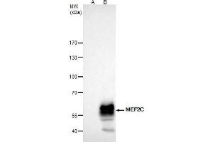 IP Image MEF2C antibody immunoprecipitates MEF2C protein in IP experiments.