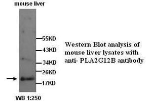 Image no. 1 for anti-Phospholipase A2, Group XIIB (PLA2G12B) (N-Term) antibody (ABIN790922)