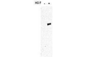 Western blot using  affinity purified anti-c-Met pY1349pY1356 antibody shows detection of phosphorylated c-Met. (c-MET anticorps  (pTyr1249, pTyr1356))