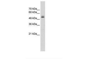 Image no. 1 for anti-Pre-mRNA Processing Factor 19 (PRPF19) (N-Term) antibody (ABIN203526) (PRP19 anticorps  (N-Term))