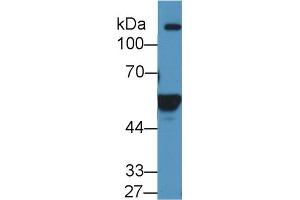 Western Blot; Sample: Human K562 cell lysate; Primary Ab: 1µg/ml Rabbit Anti-Human ALDH1A2 Antibody Second Ab: 0.