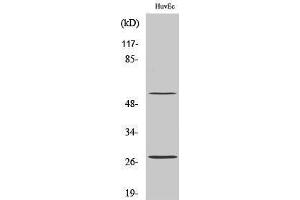 Western Blotting (WB) image for anti-CD69 (CD69) (Internal Region) antibody (ABIN3174275) (CD69 anticorps  (Internal Region))