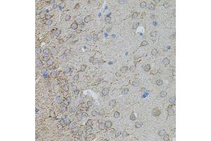 Immunohistochemistry of paraffin-embedded mouse brain using MMP10 antibody (ABIN5971553) at dilution of 1/100 (40x lens).
