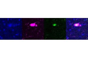 Immunohistochemistry (IHC) image for anti-SATB Homeobox 2 (SATB2) antibody (ABIN7456088) (SATB2 anticorps)