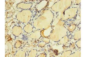 Immunohistochemistry of paraffin-embedded human thyroid tissue using ABIN7172152 at dilution of 1:100