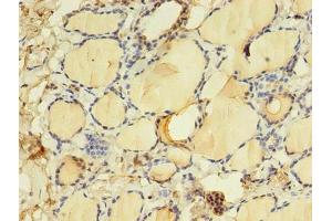 Immunohistochemistry of paraffin-embedded human thyroid tissue using ABIN7172152 at dilution of 1:100 (THRB anticorps  (AA 1-461))