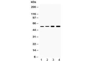 Western blot testing of 1) rat liver, 2) mouse liver, 3) human HeLa and 4) human HepG2 lysate with Cytokeratin 18 antibody at 0.