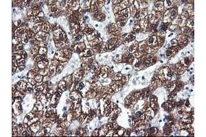 Immunohistochemical staining of paraffin-embedded Human liver tissue using anti-CYP2C9 mouse monoclonal antibody. (CYP2C9 anticorps)