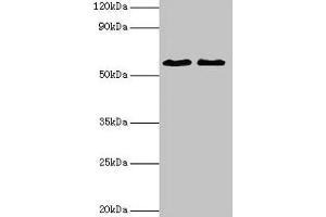 Western blot All lanes: ESR2 antibody at 2 μg/mL Lane 1: Mouse brain tissue Lane 2: PC-3 whole cell lysate Secondary Goat polyclonal to rabbit IgG at 1/10000 dilution Predicted band size: 60, 56, 36, 58, 55, 53, 49, 42, 54 kDa Observed band size: 60 kDa (ESR2 anticorps  (AA 2-530))