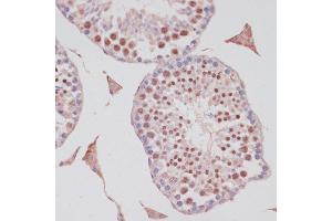 Immunohistochemistry of paraffin-embedded mouse testis using S100P antibody (ABIN7270133) at dilution of 1:100 (40x lens).