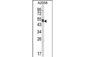 Western blot analysis of AGPAT3 Antibody in A2058 cell line lysates (35ug/lane) (AGPAT3 anticorps  (AA 241-269))