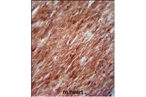 IL2 Antibody (Center) (ABIN390899 and ABIN2841106) immunohistochemistry analysis in formalin fixed and paraffin embedded mouse heart tissue followed by peroxidase conjugation of the secondary antibody and DAB staining. (IL-2 anticorps  (AA 50-77))