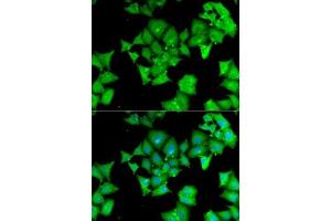 Immunofluorescence analysis of MCF7 cells using  antibody (ABIN6127428, ABIN6136509, ABIN6136511 and ABIN6217463). (Aminoacylase 1 anticorps  (AA 1-408))